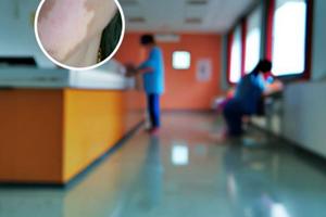 補骨脂酊和他克莫司軟膏可以一起用嗎